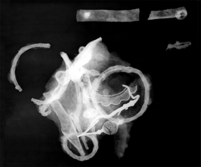 Röntgenfelvétel a földlabdában lévő leletekről